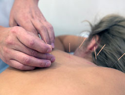 our services accupuncture
